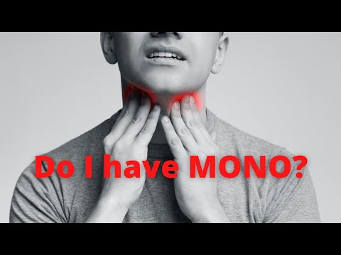 Infectious Mononucleosis:  How To Diagnose & Treat