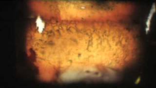 Light-sleep (Félálom)