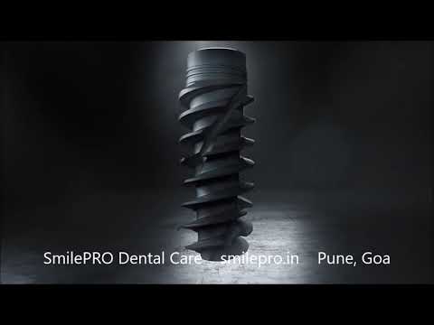 Dental Implants with SmilePRO..the Straumann #BLXperience