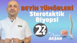 Beyin Tümörleri | 2.2 Sterotaktik Biyopsi | Dr Özgür Akşan