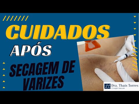Cuidados após secagem de varizes ( escleroterapia ou aplicação )