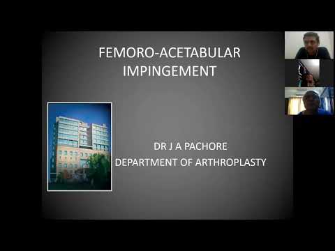 TO PASS DNB/MS ORTHOPAEDICS-CASE 73(A)- FAI - LECTURE BY DR. J A PACHORE
