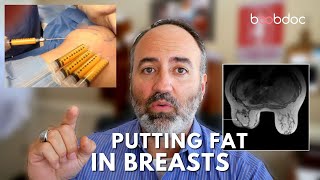 [討論] 小胸考慮自體脂肪豐胸 