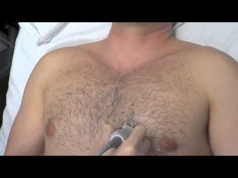 Transthoracic Echocardiogram General