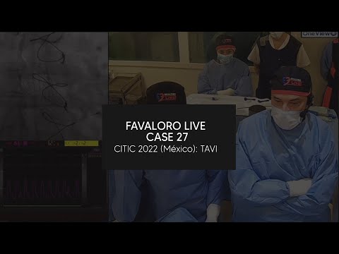 Favaloro Live Case N° 27 - CITIC 2022 (México): TAVI