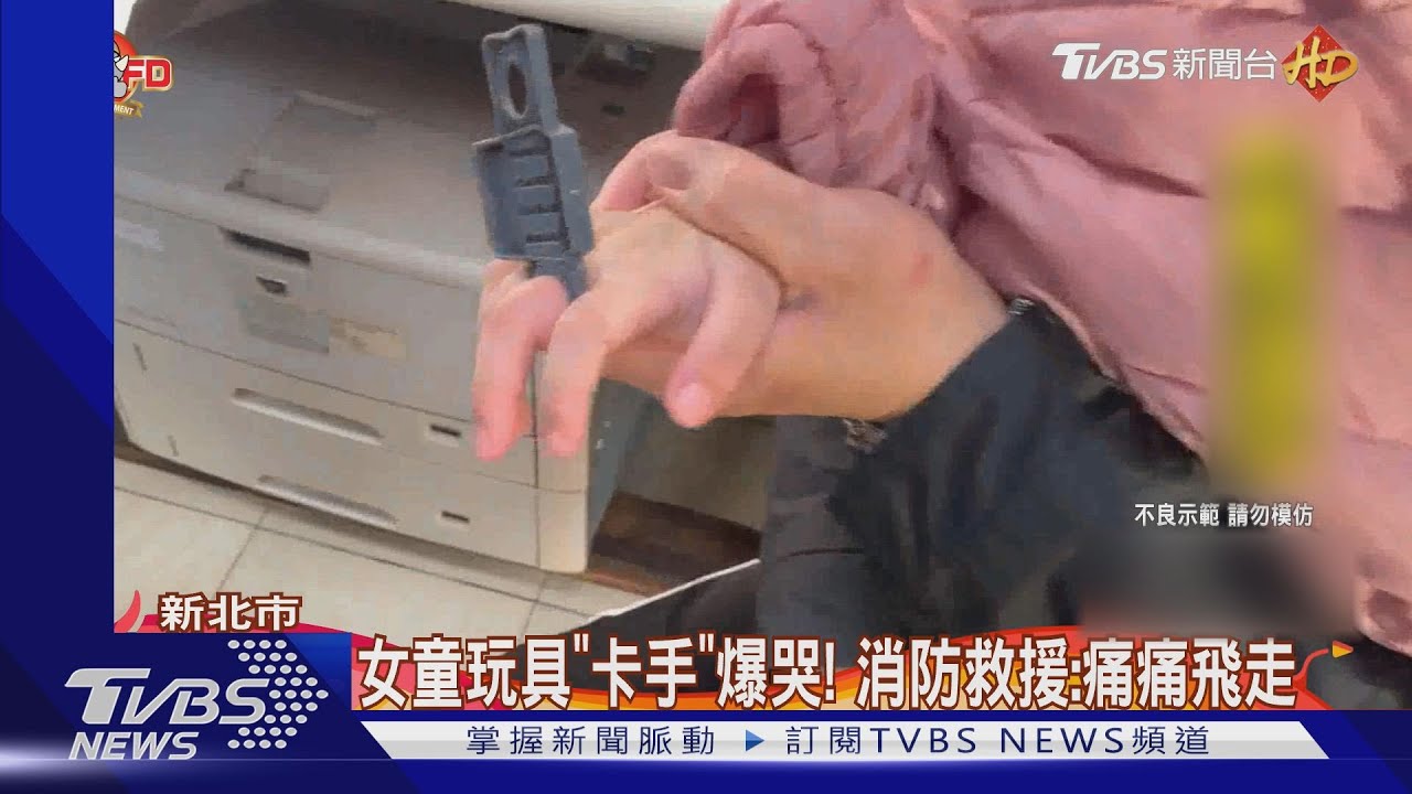 女童玩具「卡手」爆哭！　消防救援：痛痛飛走