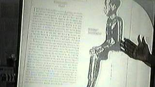 PROSTATE DISEASE CAUSE AND CURE: DR LLAILA O AFRIKA