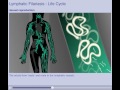 Lymphatic Filariasis (Elephantiasis) - Life Cycle