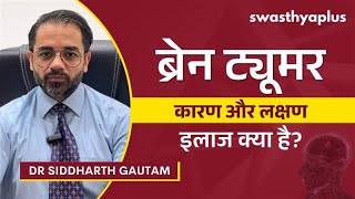 ब्रेन एन्यूरिज्म: कारण और उपचार | What is Brain Aneurysm? in Hindi | Symptoms | Dr Siddh