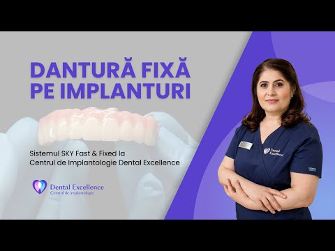 Sistemul SKY fast & fixed