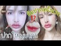 ฉีด ฟิลเลอร์ ปาก