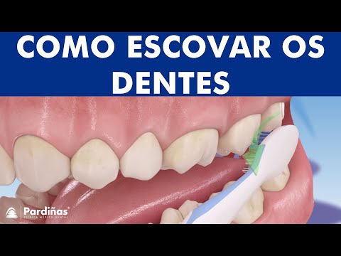 Como escovar os dentes corretamente ©