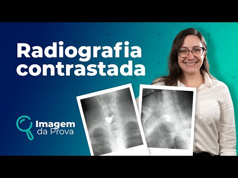 Imagem da Prova: Radiografia Contrastada | Radiografia | Medway