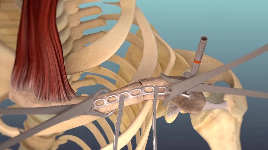 Carlos Escalante Saavedra-27