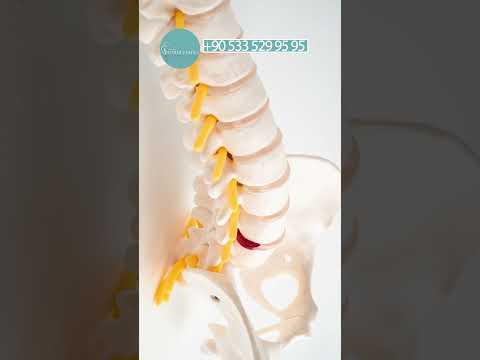 Bel fıtığı nedir? - Prof. Dr. Onur Yaman