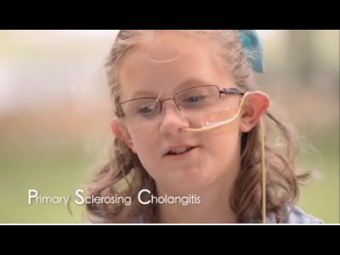 Faces of Primary Sclerosing Cholangitis (PSC)