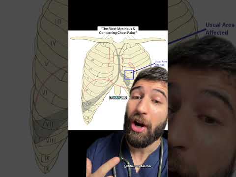 Doctor Explains Concerning Chest Pains