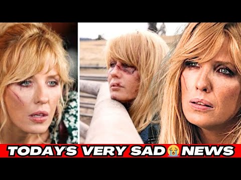 Beth Dutton Bruised Face