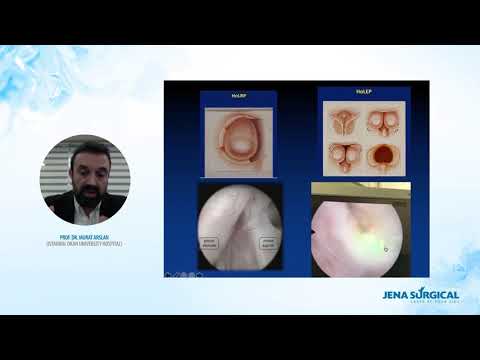 Webinar: Is HoLEP the Gold Standard?