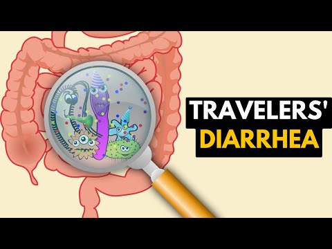 Hepatitis Causes Signs and Symptoms Diagnosis and Treatment