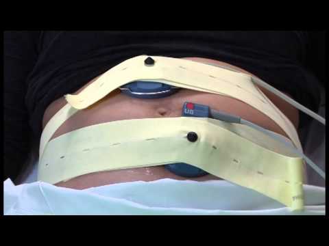 Fetal Monitoring During Labour