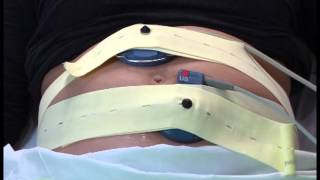 Thumbnail for Video #14: Fetal Monitoring During Labour