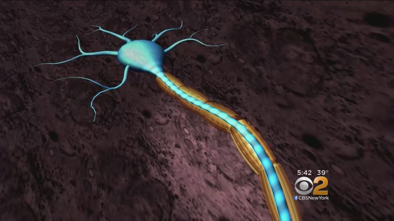 New Stem Cell Treatment Offers Hope For MS Patients