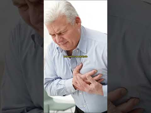 MYSTERIOUS DANCE EPIDEMIC, 1518