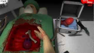preview picture of video 'Surgeon simulator 2013 - Un jeu de merde comme on les aime...'