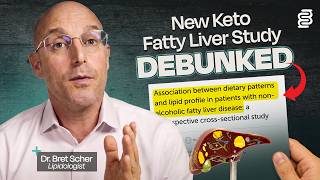 Lipidologist Questions the New Keto and Liver Disease Study