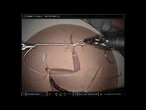 Creating a Slip knot Using the DaVinci Surgical System