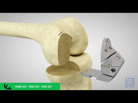 K-MONO Operating Technique