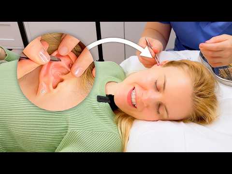 ASMR Ear seeds with acupressure points (Unintentional ASMR, real person ASMR)