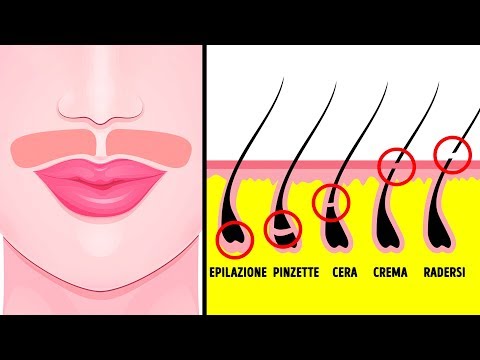 I pigmentary notano su una natica Macchie scure dinvecchiamento su pelle