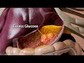 How Food Turns Into Body Fat