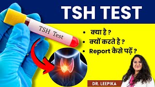 Download lagu TSH Test in Hindi - TSH Test Kaise Kiya Jata Hai? Report Kaise Dekhe? mp3 Download lagu TSH Test in Hindi - TSH Test Kaise Kiya Jata Hai? Report Kaise Dekhe? mp3