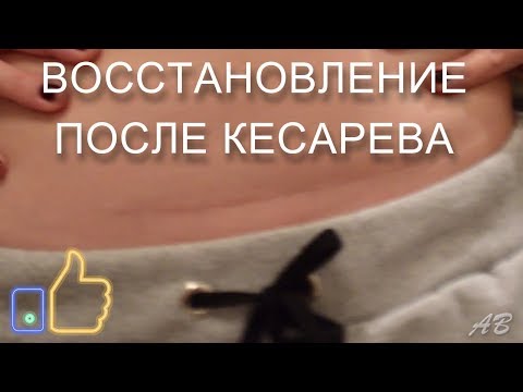 Почему болит поясница при вставании Внезапная боль в позвоночнике грудной отдел