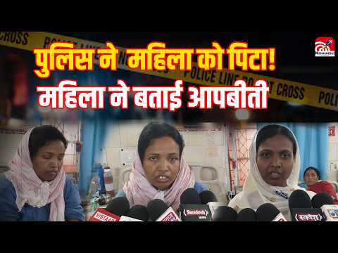 CRIME NEWS: Police पर महिला को बेरहमी से पीटने का आरोप! शरीर पर चोट के निशान, महिला ने बताई आपबीती