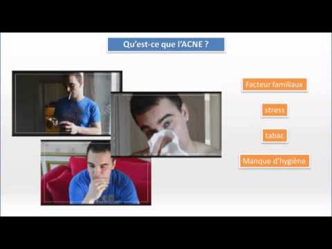 comment traiter l'acné vulgaire