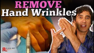 HAND FILLER // How to Remove Hand Wrinkles
