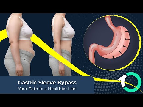 Laparoscopic Roux-en-Y Gastric Bypass Surgery - Surgical Procedure - One Clinic Patient Review Video