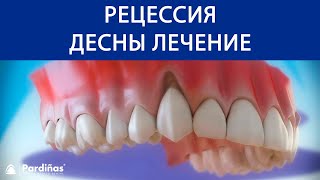 Эффективные средства для укрепления десен и зубов