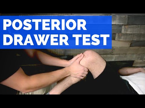 Posterior Drawer Test for PCL Tears