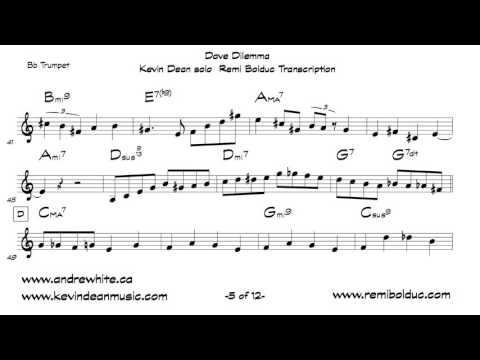 Kevin Dean on Dave's Dilemma