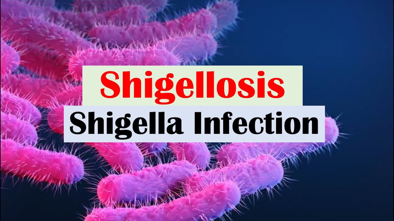 Shigellosis (Shigella) “A Cause of Bloody Diarrhea”: Pathophysiology, Symptoms, Diagnosis, Treatment