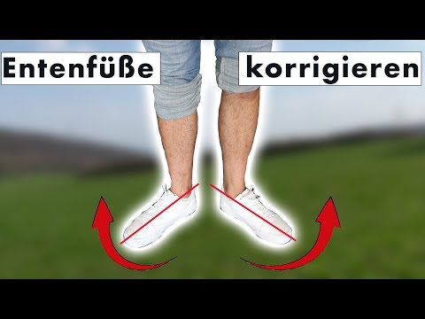 Fuß zeigt nach Außen (Entenfuß, Entengang) korrigieren | Ursache & SOFORTLÖSUNG