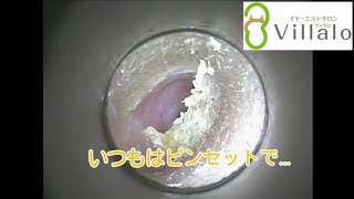 耳掃除動画vol.51「いつもはピンセットで…」