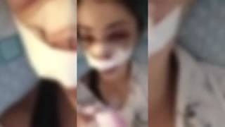 Bari, ragazza presa a calci al Parco Rossani: «La gente guardava e non faceva nulla. Ho chiamato ...