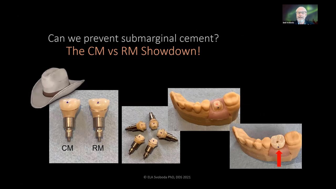 Webinar: Chamfer Margin Showdown, Bringing a New Standard of Care to Town