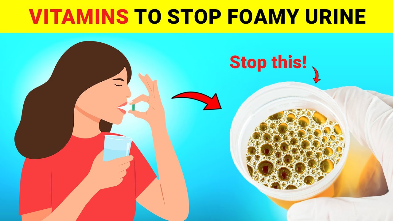 Top 3 Vitamins That Help Stop Proteinuria and Heal Your Kidneys